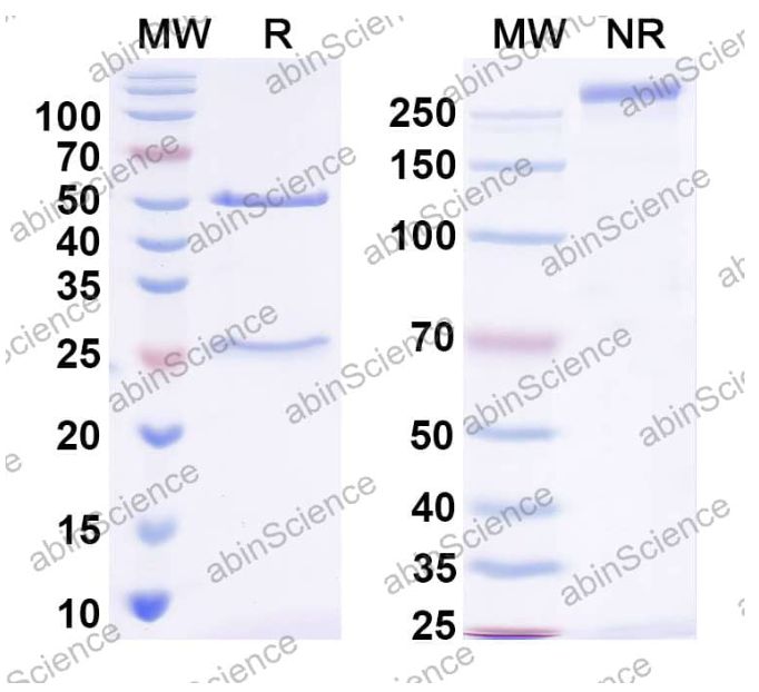 Abinscience InVivoMAb Anti-Mouse IL-11 R alpha Antibody (SAA2520) (MC604020-100ug)