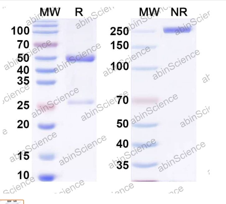 Abinscience InVivoMAb Anti-Human Wnt-2 Antibody (Iv0252) (HY144020-50ug)