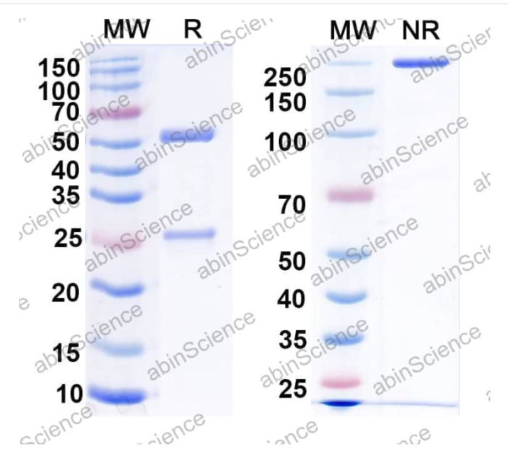 Abinscience InVivoMAb Anti-Human, Mouse Galectin-3 Antibody (TB001) (MB167010-50ug)