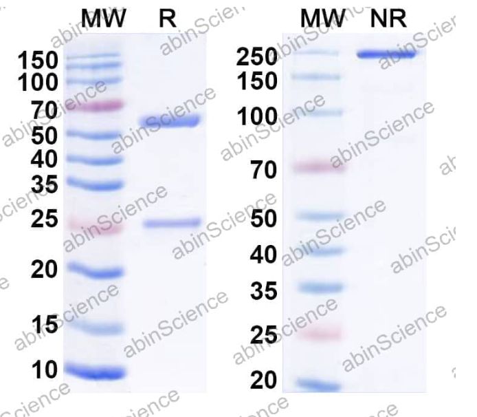 Abinscience InVivoMAb Anti-Human Factor VIII Antibody (3E6#) (HF987070-1mg)