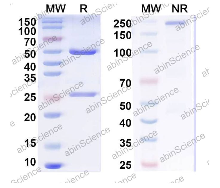 Abinscience InVivoMAb Anti-Human Factor VIII Antibody (G99) (HF987080-100ug)