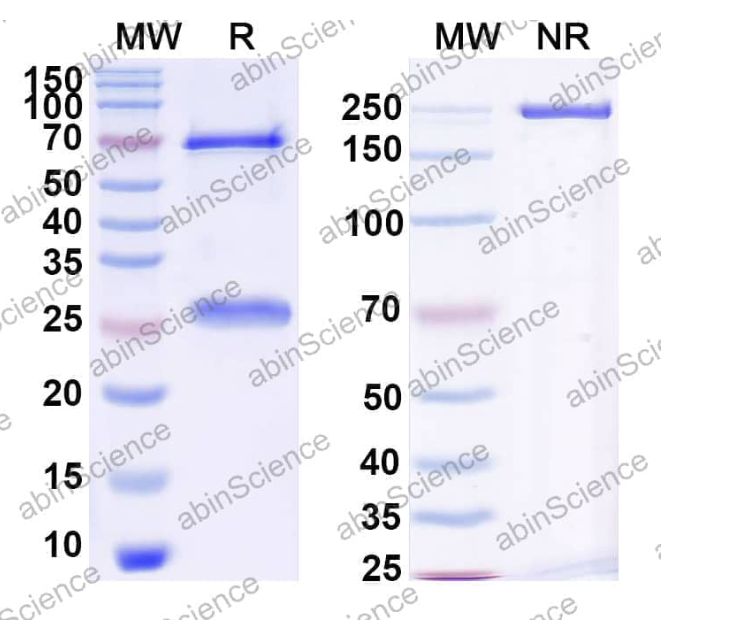 Abinscience InVivoMAb Anti-Human Fc gamma RIIIA/CD16a Antibody (MEM-154) (HY386030-1mg)