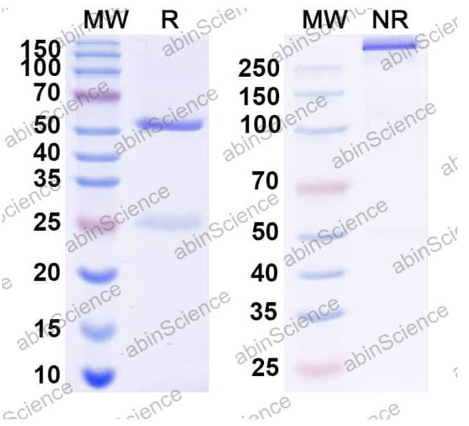 Abinscience InVivoMAb Anti-Human RAGE/AGER Antibody (11E6#) (HS925020-50ug)
