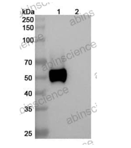 Abinscience InVivoMAb Anti-Human RAGE/AGER Antibody (4E5#) (HS925030-50ug)