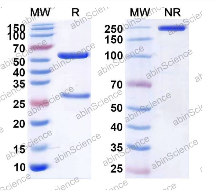 Abinscience InVivoMAb Anti-Human Factor VIII Antibody (2A9) (HF987050-1mg)