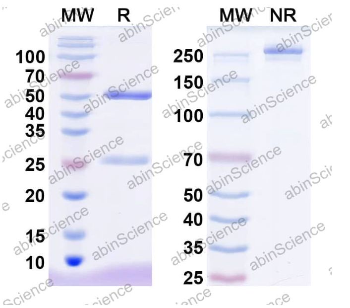Abinscience InVivoMAb Anti-Mouse ANGPTL4 Antibody (4A8) (HV344020-1mg)