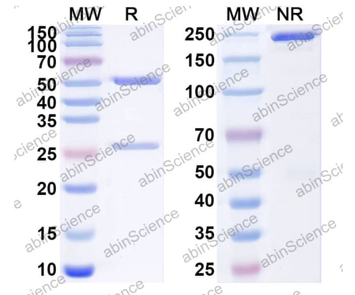 Abinscience InVivoMAb Anti-Human IFN-alpha/beta R1 Antibody (H3K1) (HB823010-50ug)