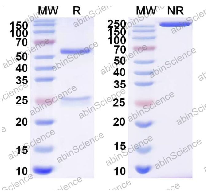 Abinscience InVivoMAb Anti-Human FCRN Antibody (Iv0203) (HX061010-50ug)