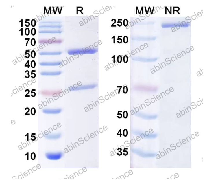 Abinscience InVivoMAb Anti-Human ROBO2 Antibody (93H2) (HA097010-100ug)