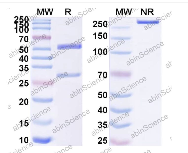Abinscience InVivoMAb Anti-Human Complement Component C1s Antibody (TNT003) (HY598010-1mg)