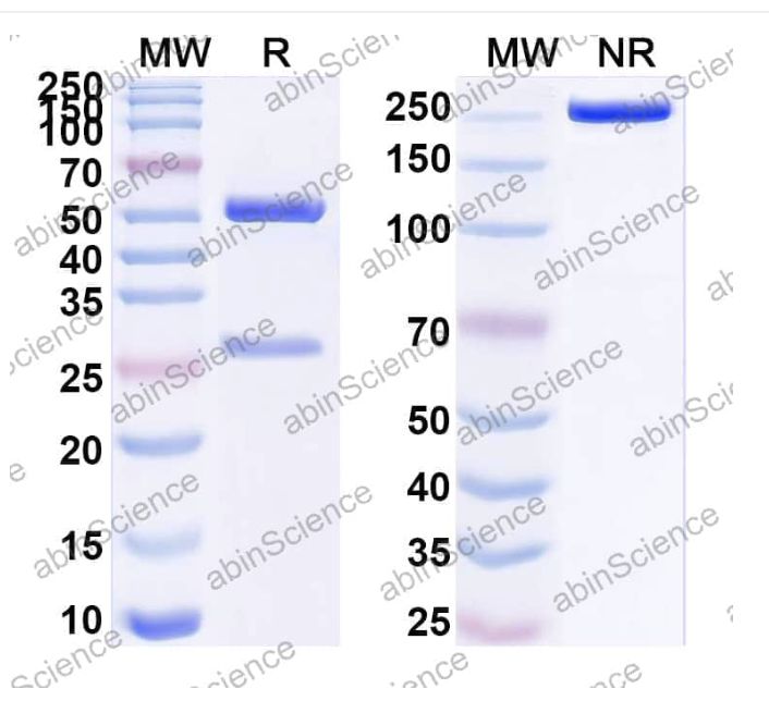 Abinscience InVivoMAb Anti-Human ACE2 Antibody (05B04) (HV157010-100ug)