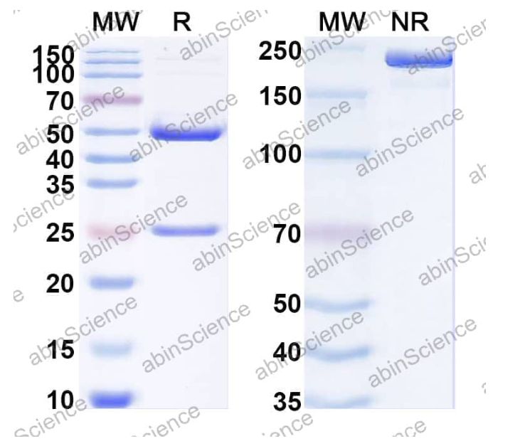 Abinscience InVivoMAb Anti-SARS-CoV-2 S2 Antibody (18H2) (VK749060-50ug)