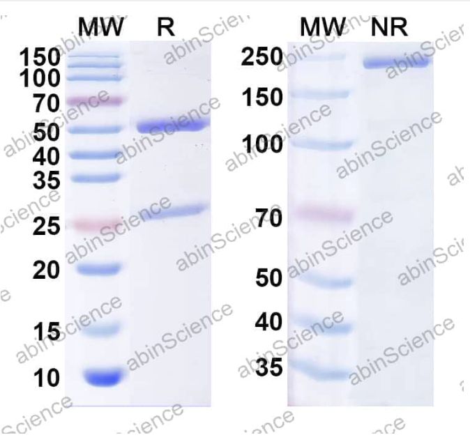Abinscience InVivoMAb Anti-Human Claudin-3 Antibody (CDN04) (HT443010-1mg)