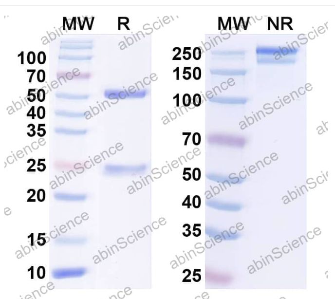 Abinscience InVivoMAb Anti-Human BAD-LAMP/LAMP5 Antibody (D2) (HP074010-1mg)