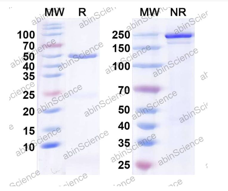 Abinscience InVivoMAb Anti-Human alpha-Synuclein Antibody (Iv0175) (HW755040-100ug)