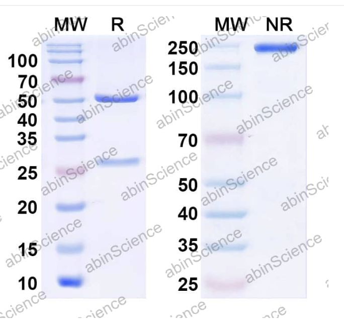 Abinscience InVivoMAb Anti-Human Factor VIII Antibody (KM33) (HF987020-1mg)