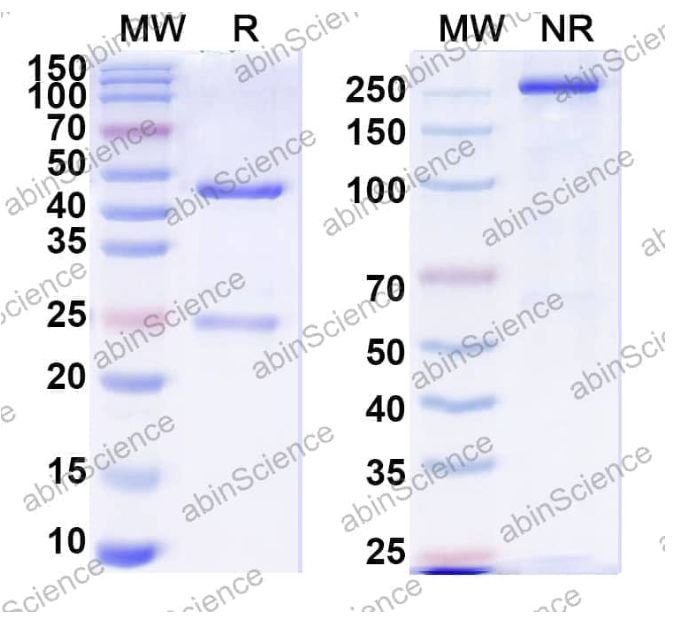 Abinscience InVivoMAb Anti-Human Factor VIII Antibody (KM41) (HF987030-100ug)