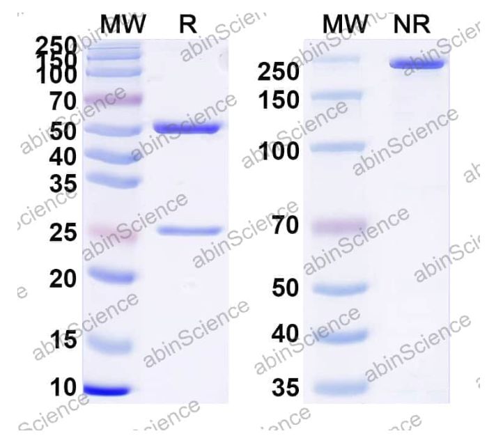 Abinscience InVivoMAb Anti-Human TSHR Antibody (5C9) (HB852020-100ug)