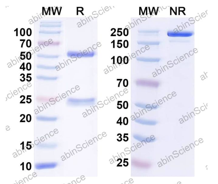 Abinscience InVivoMAb Anti-Human TREML1/TLT-1 Antibody (Iv0130) (HP548010-1mg)