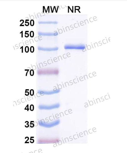 Abinscience InVivoMAb Anti-Human VSIG4 Antibody (Iv0141) (HP545010-100ug)