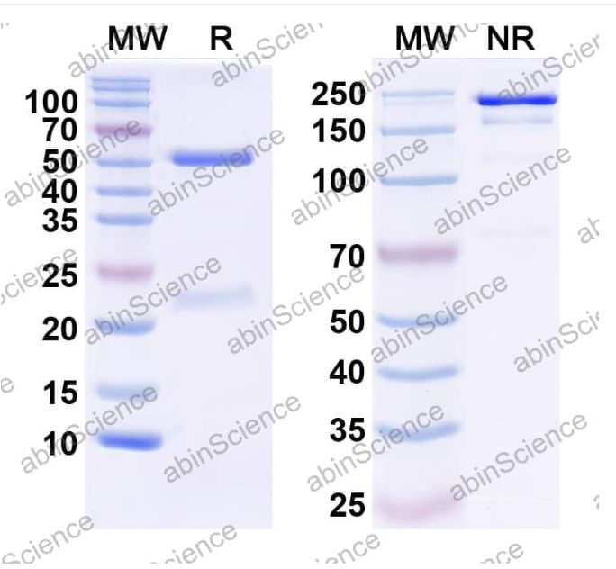 Abinscience InVivoMAb Anti-Human CXCL9/MIG Antibody (Iv0087) (HC487010-100ug)
