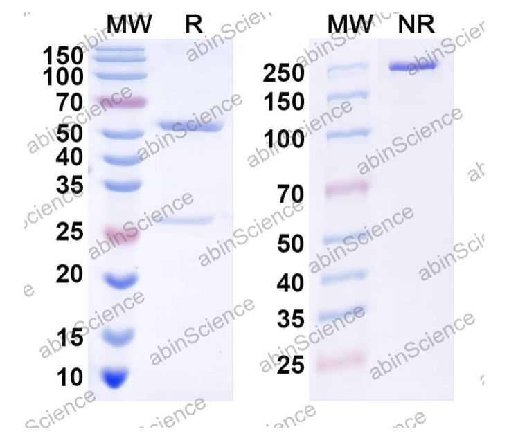 Abinscience InVivoMAb Anti-Rotavirus A/RV-A Outer capsid glycoprotein VP7 Antibody (Iv0011) (VK603010-50ug)