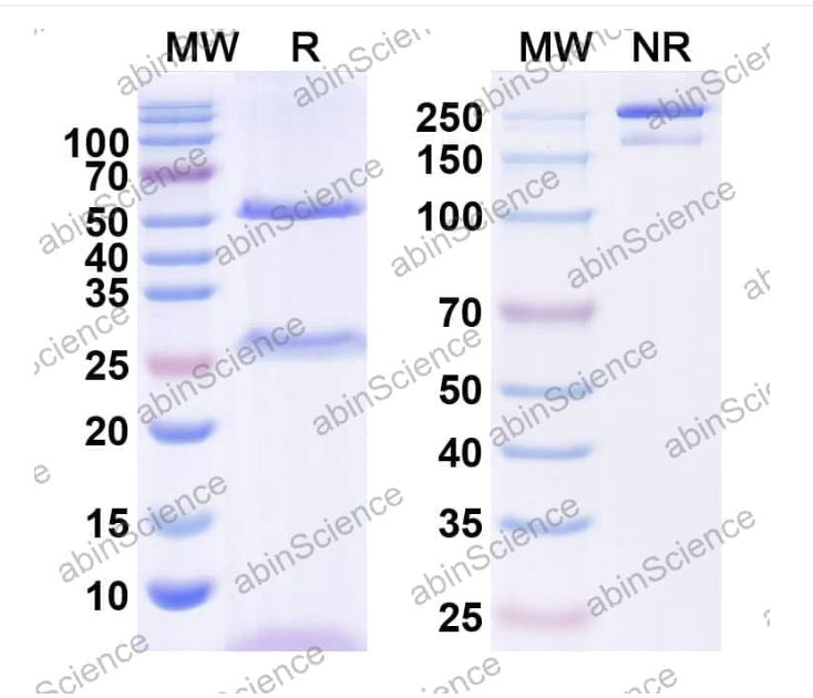 Abinscience InVivoMAb Anti-Human IL-2 R beta Antibody (Iv0106) (HB912010-1mg)