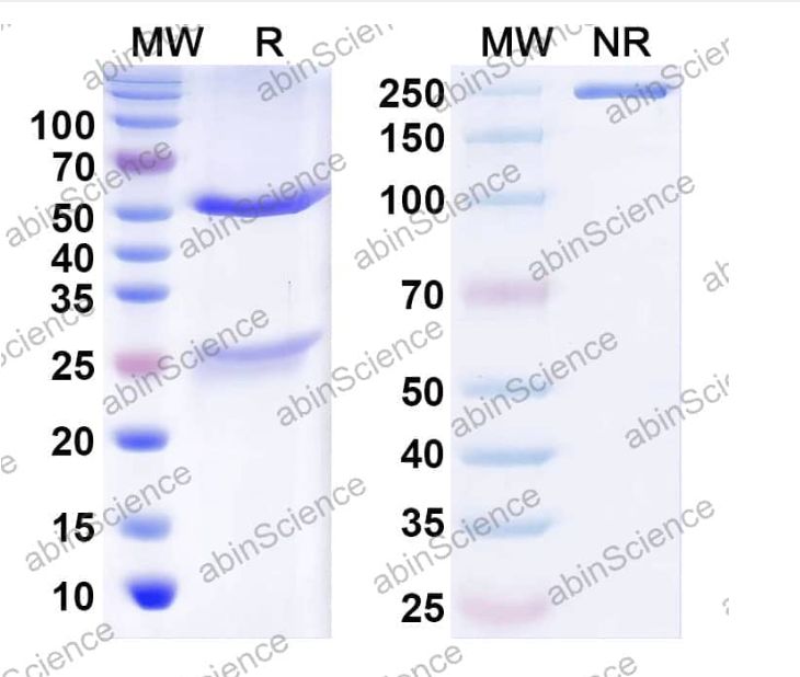 Abinscience InVivoMAb Anti-Human Factor VIII Antibody (KRIX-1) (HF987010-100ug)