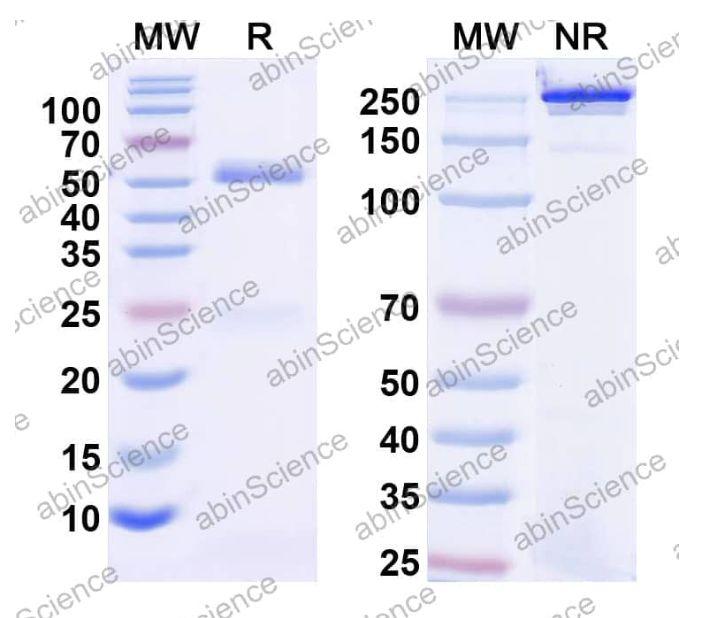 Abinscience InVivoMAb Anti-Human common gamma chain/IL-2R gamma Antibody (Iv0107) (HB675010-1mg)