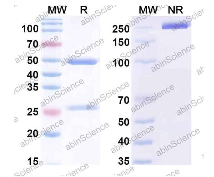 Abinscience InVivoMAb Anti-Human IL-21 Antibody (Iv0032) (HV658010-50ug)