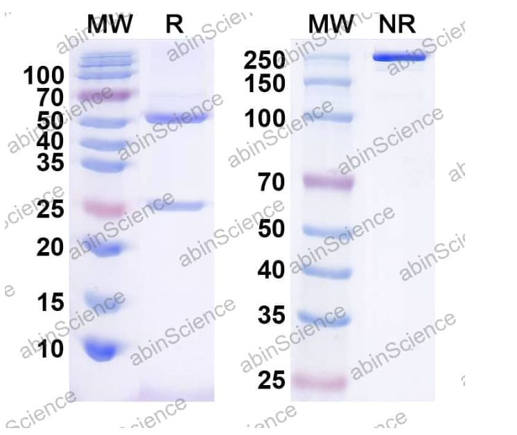 Abinscience InVivoMAb Anti-Human TNF RII/TNFRSF1B Antibody (SAA0309) (HB070010-50ug)