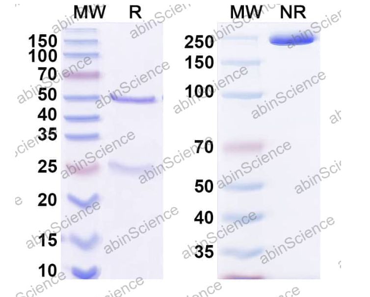 Abinscience Anti-Human Transthyretin amyloidosis Recombinant Antibody (9D5) (HP217013-1mg)