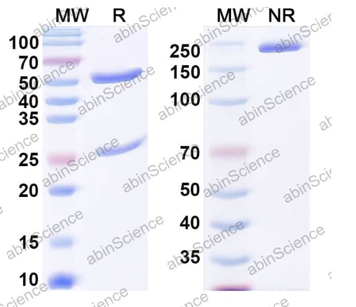 Abinscience Anti-Human Transthyretin amyloidosis Recombinant Antibody (5A1) (HP217043-50ug)