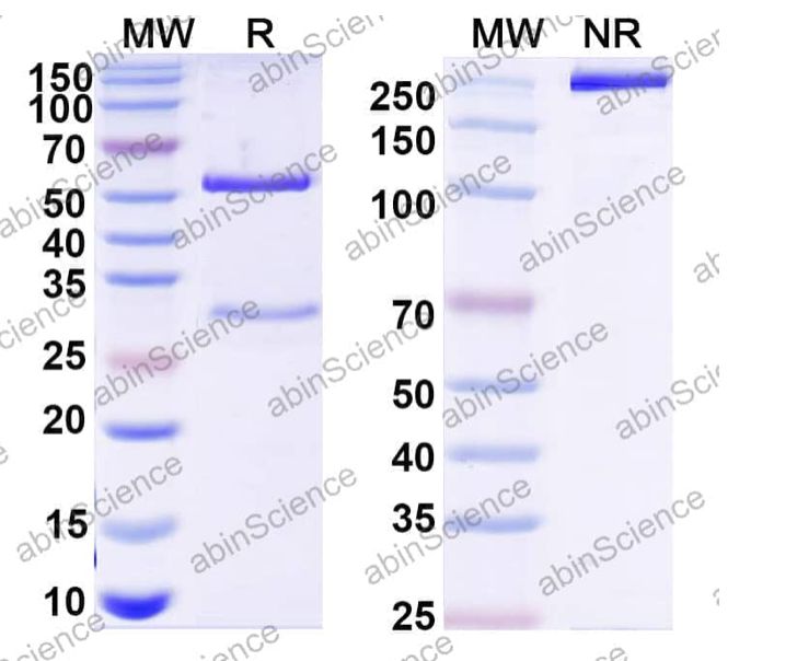 Abinscience Anti-Human ADAMTS5 Recombinant Antibody (7B4) (HV374023-1mg)