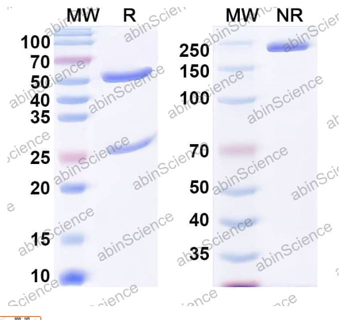 Abinscience Anti-Human Transthyretin amyloidosis Recombinant Antibody (6C1) (HP217033-50ug)