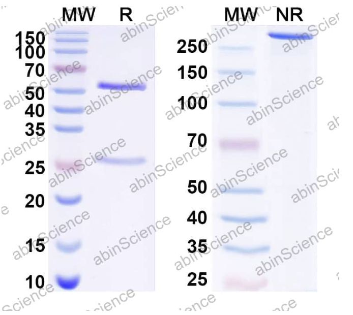 Abinscience Anti-Human ADAMTS5 Recombinant Antibody (12F4) (HV374013-100ug)