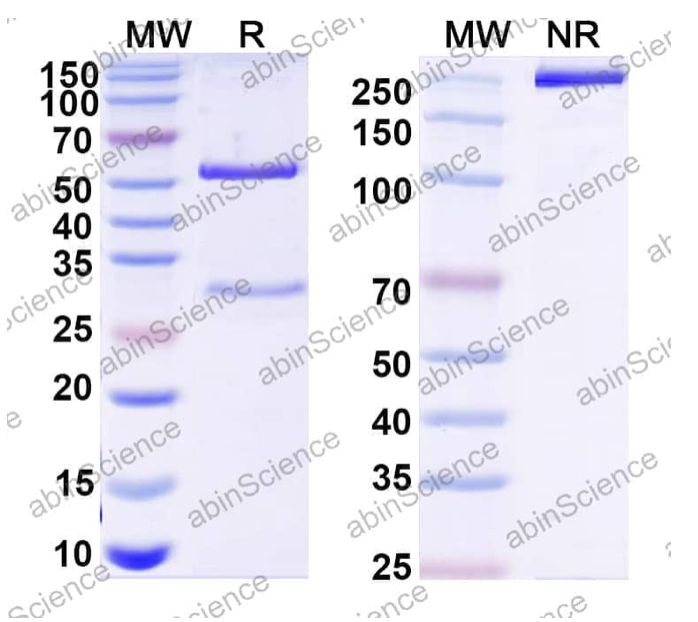 Abinscience Anti-Human ADAMTS4 Recombinant Antibody (4D8) (HF893013-100ug)
