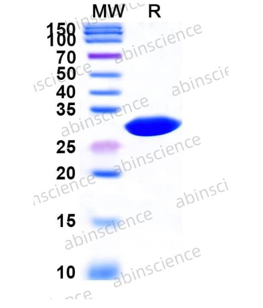Abinscience InVivoMAb Anti-Human Von Willebrand Factor Antibody (12A2H1) (HY255010-50ug)