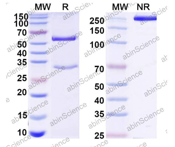 Abinscience Anti-Human ADAMTS4 Recombinant Antibody (7C7) (HF893023-1mg)