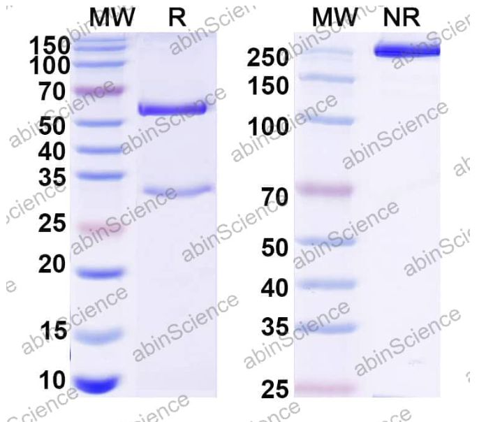 Abinscience Anti-Human ADAMTS4 Recombinant Antibody (7G4) (HF893043-1mg)