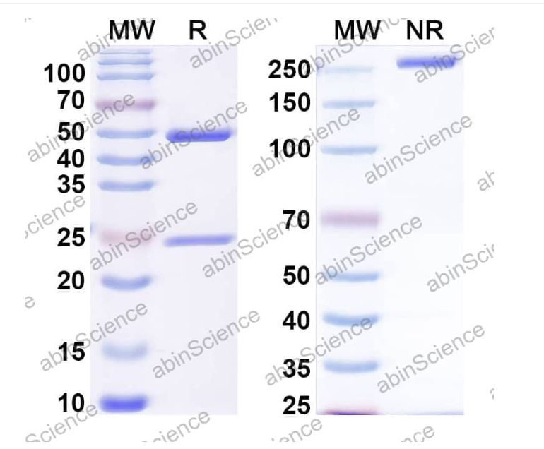 Abinscience Anti-Human ADAMTS4 Recombinant Antibody (7E8#) (HF893033-1mg)