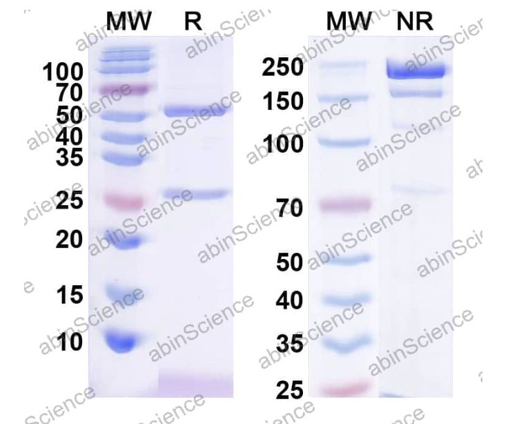 Abinscience InVivoMAb Anti-Canine IL-31 Antibody (Iv0213) (CV678010-1mg)