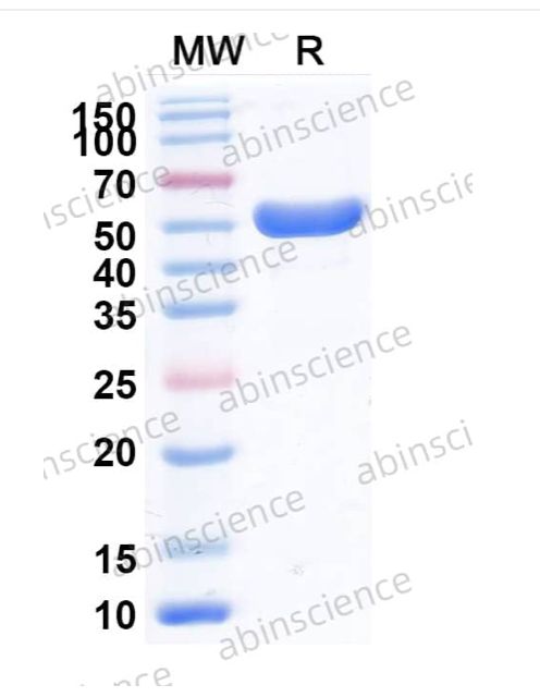 Abinscience InVivoMAb Anti-Human TREM-1 & CD46 Antibody (SAA2036) (HV219010-100ug)