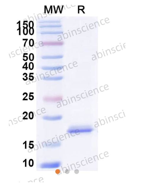 Abinscience InVivoMAb Anti-Human Cannabinoid R1/CB1/CNR1 Antibody (5D12) (HB822010-50ug)