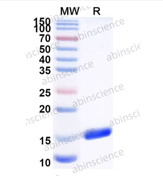 Abinscience InVivoMAb Anti-Campylobacter jejuni subsp. wlaB/pglK Nanobody (Iv0202) (JN929010-100ug)