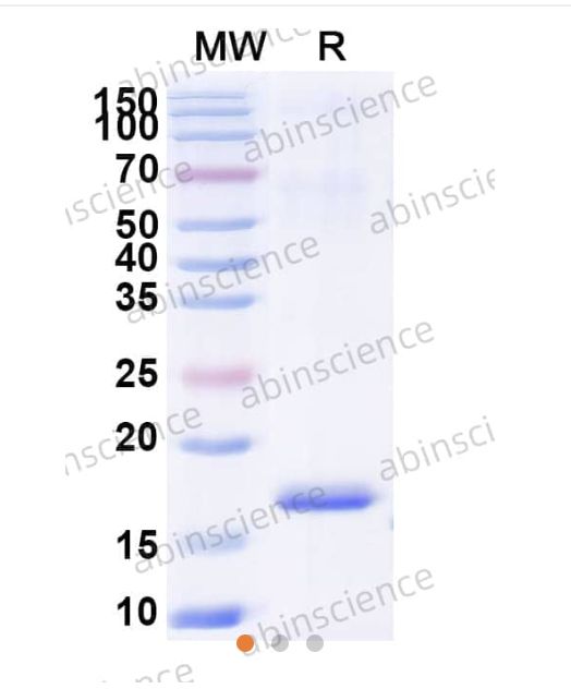 Abinscience InVivoMAb Anti-Human Cannabinoid R1/CB1/CNR1 Antibody (6B7) (HB822030-50ug)
