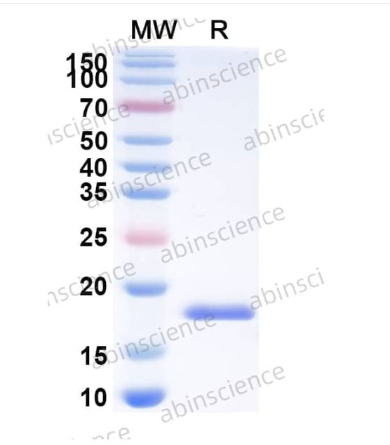 InVivoMAb Anti-HHV-5/HCMV HHRF3/US28 Antibody(Iv0102) (VK595010-1mg)