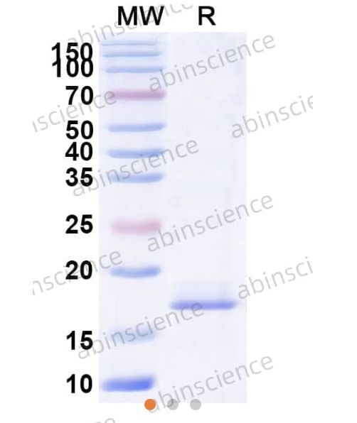 Abinscience InVivoMAb Anti-Human Cannabinoid R1/CB1/CNR1 Antibody (5G11) (HB822020-50ug)