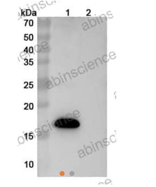 Abinscience Anti-Human APP Reference Antibody (Sabirnetug, RUO) (HP849016)