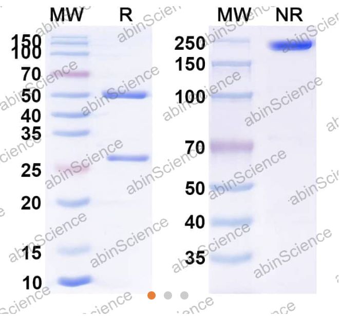 Abinscience Anti-Human TREM2 Reference Antibody (AL2p-58, RUO) (HV166026)